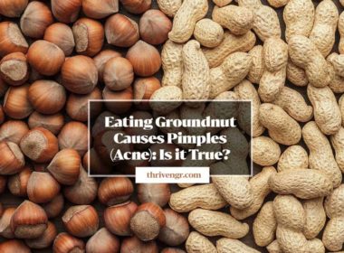 groundnut causes pimples