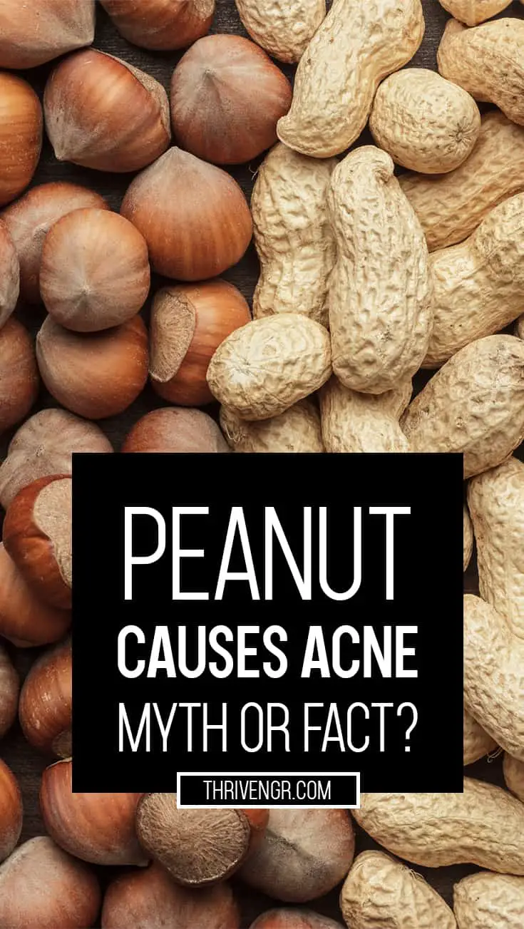 Groundnut Causes Pimples
