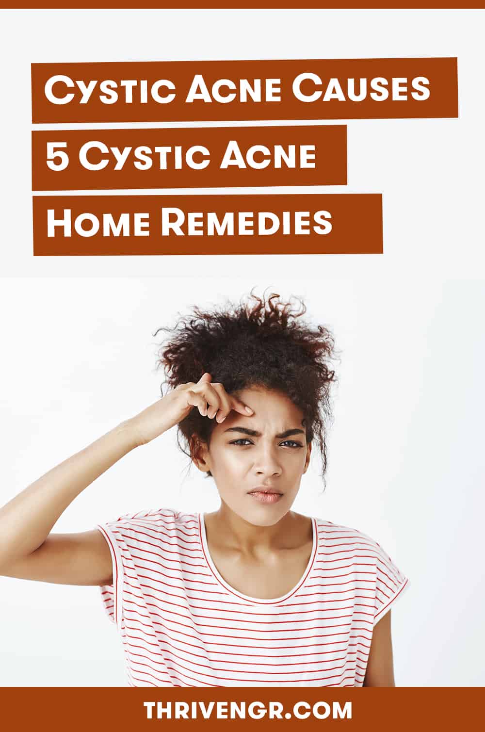 cystic acne home remedies