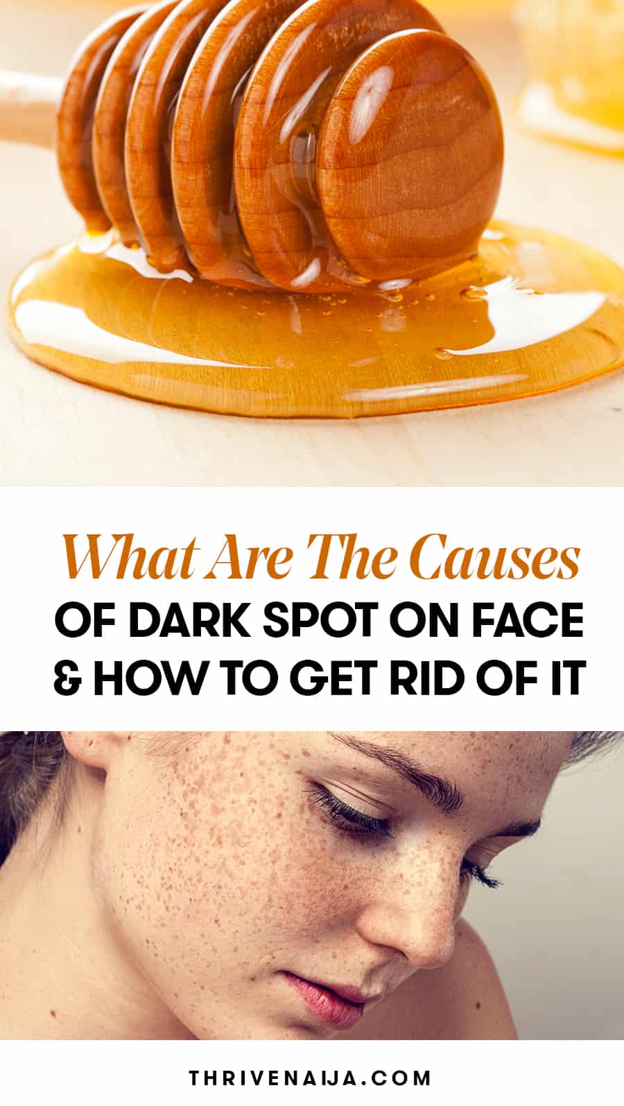 dark spot on face causes