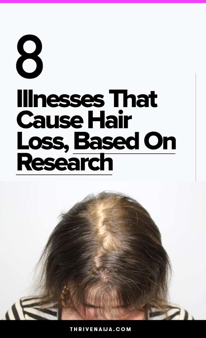 illnesses that cause hair loss
