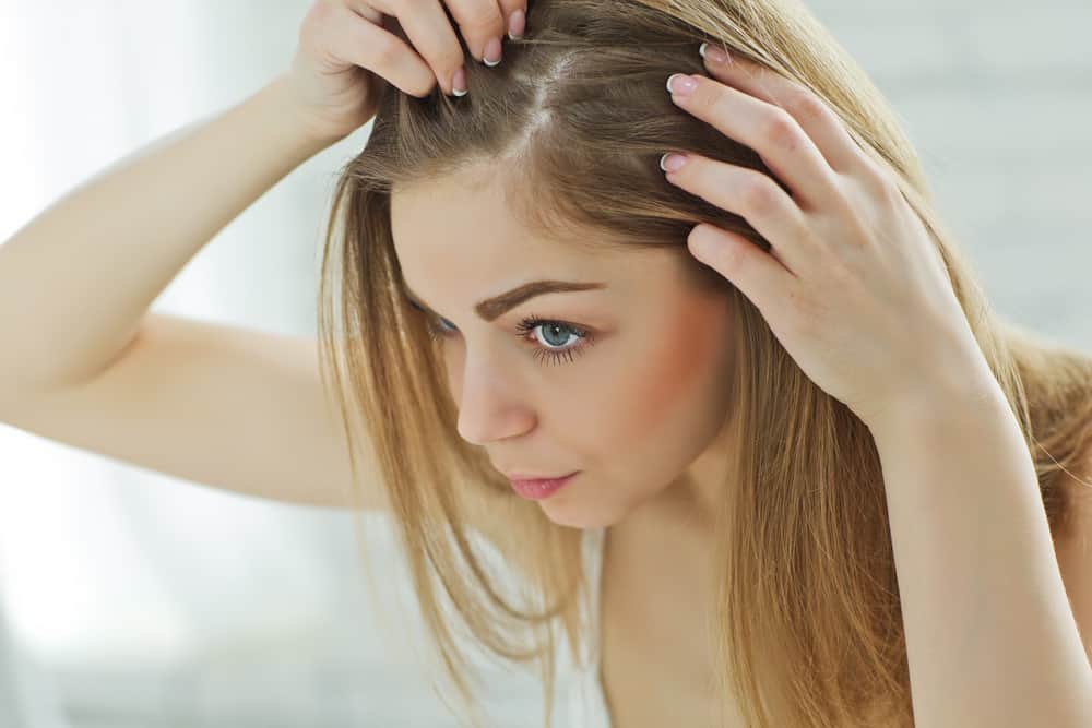 illness that cause hair loss