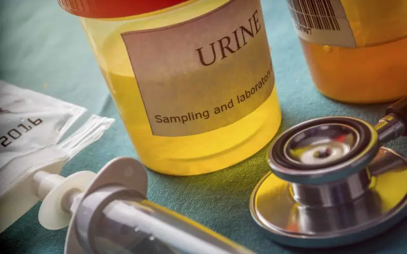 Doctor working with urine samples in a clinical laboratory