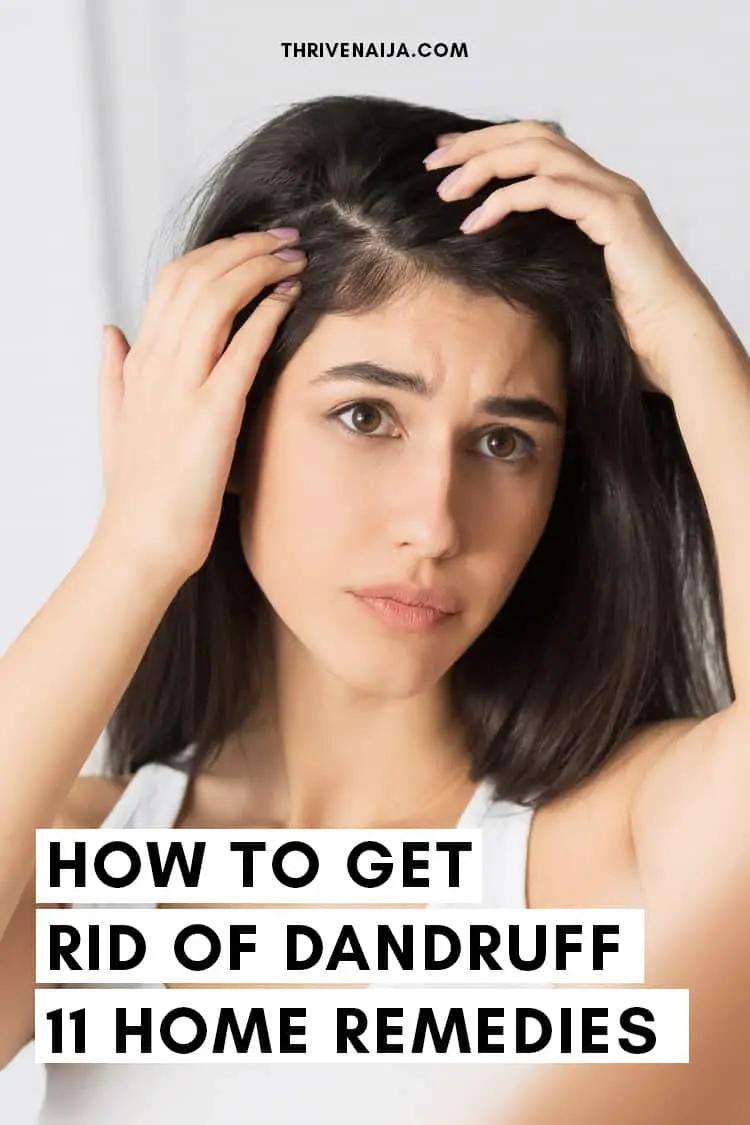 how to get rid of dandruff with home remedies